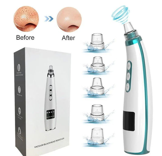 Electric Blackhead Remover & Pore Vacuum Cleaner | Rechargeable Facial Pore Cleaner for Blackheads, Oil & Deep Cleansing /جهاز إزالة الرؤوس السوداء الكهربائي ومنظف المسام بالشفط